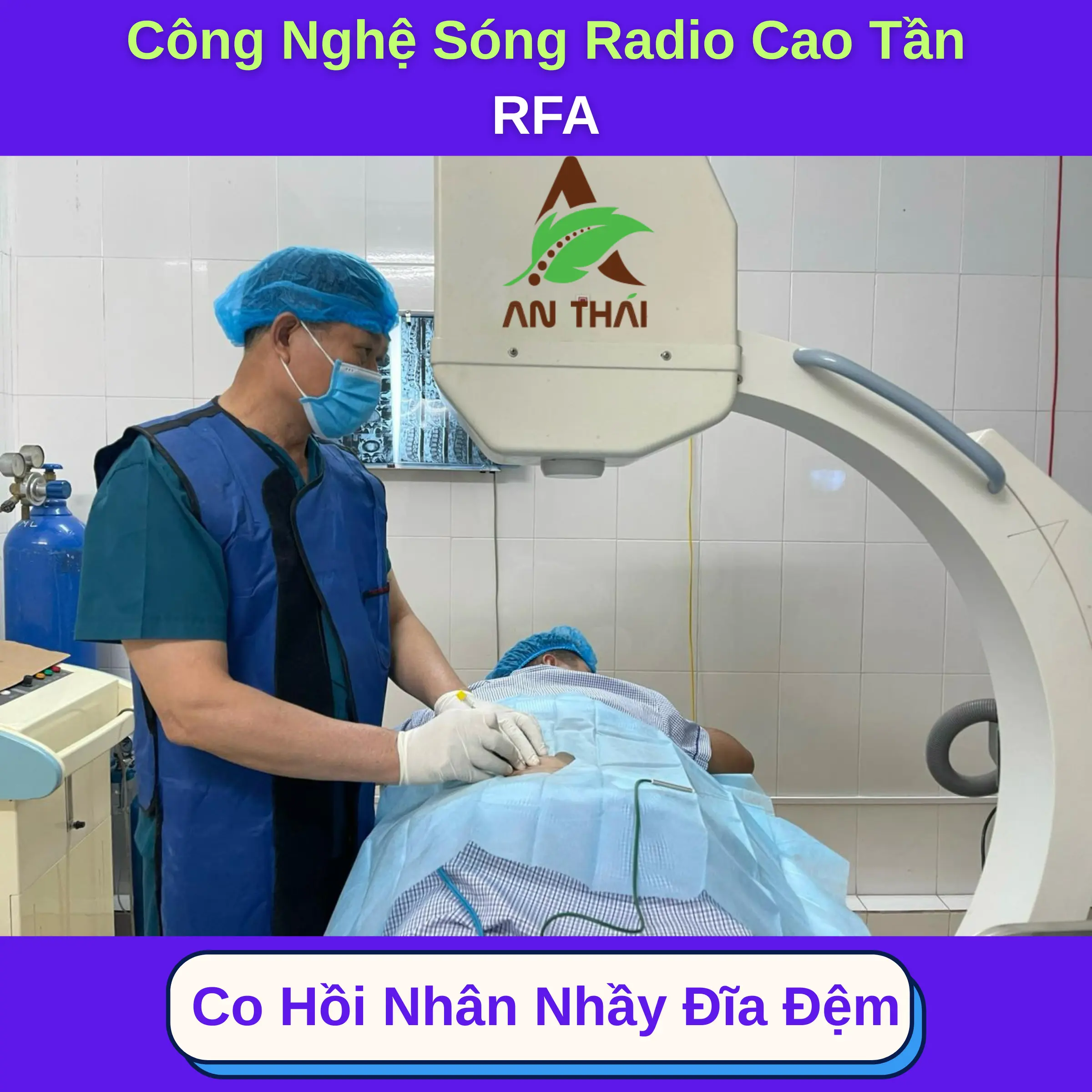 Công nghệ Sóng Radio Cao Tần RFA